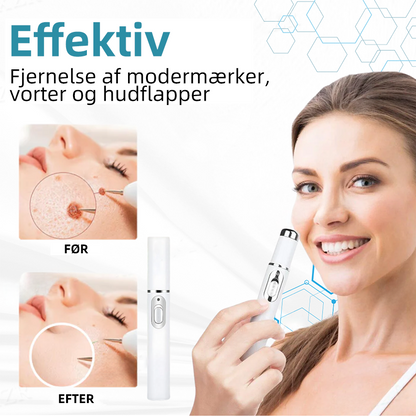 Pletvæk™ | Klar hud på en enkel måde - ingen nåle, ingen smerte!
