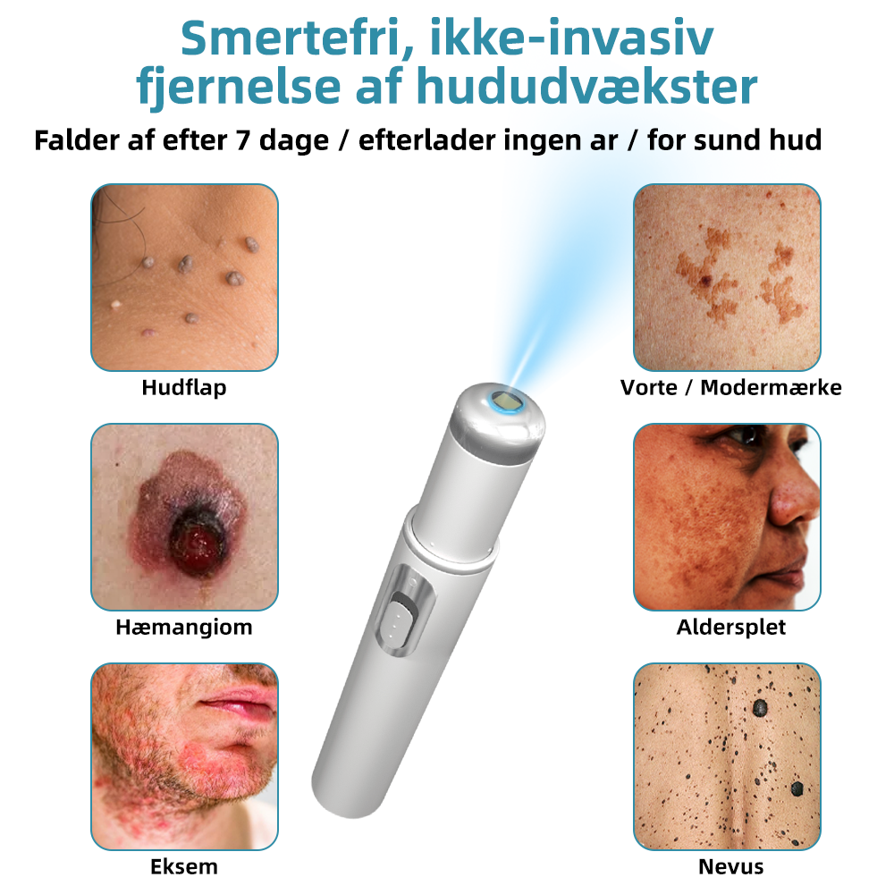 Pletvæk™ | Klar hud på en enkel måde - ingen nåle, ingen smerte!