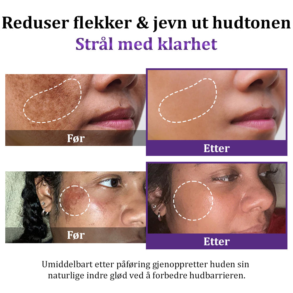 MagiskCreme™ | Et hurtigt fix til pletter og ujævn tone