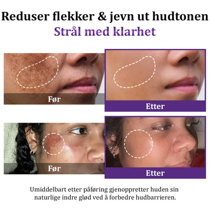MagiskCreme™ | Et hurtigt fix til pletter og ujævn tone