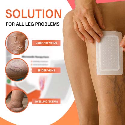 MikroPatch™ | Øjeblikkelig lindring af åreknuder og trætte ben, uden brug af nåle!